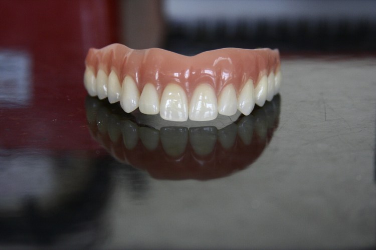 Recondent.ro - Tehnica Dentara Timisoara - Restaurari Protetice pe Implanturi