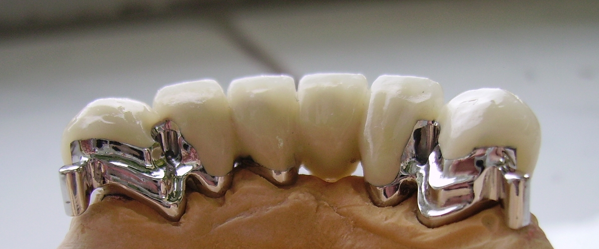 Recondent.ro - Tehnica Dentara Timisoara - Restaurari Protetice Mobilizabile