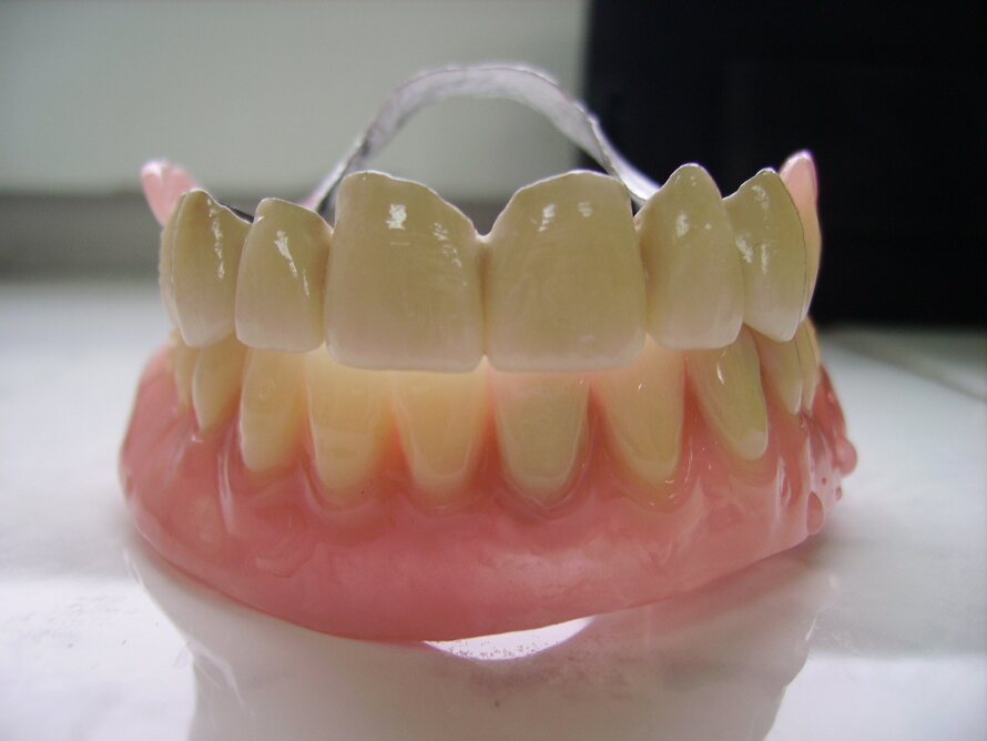 Recondent.ro - Tehnica Dentara Timisoara - Restaurari Protetice pe Implanturi